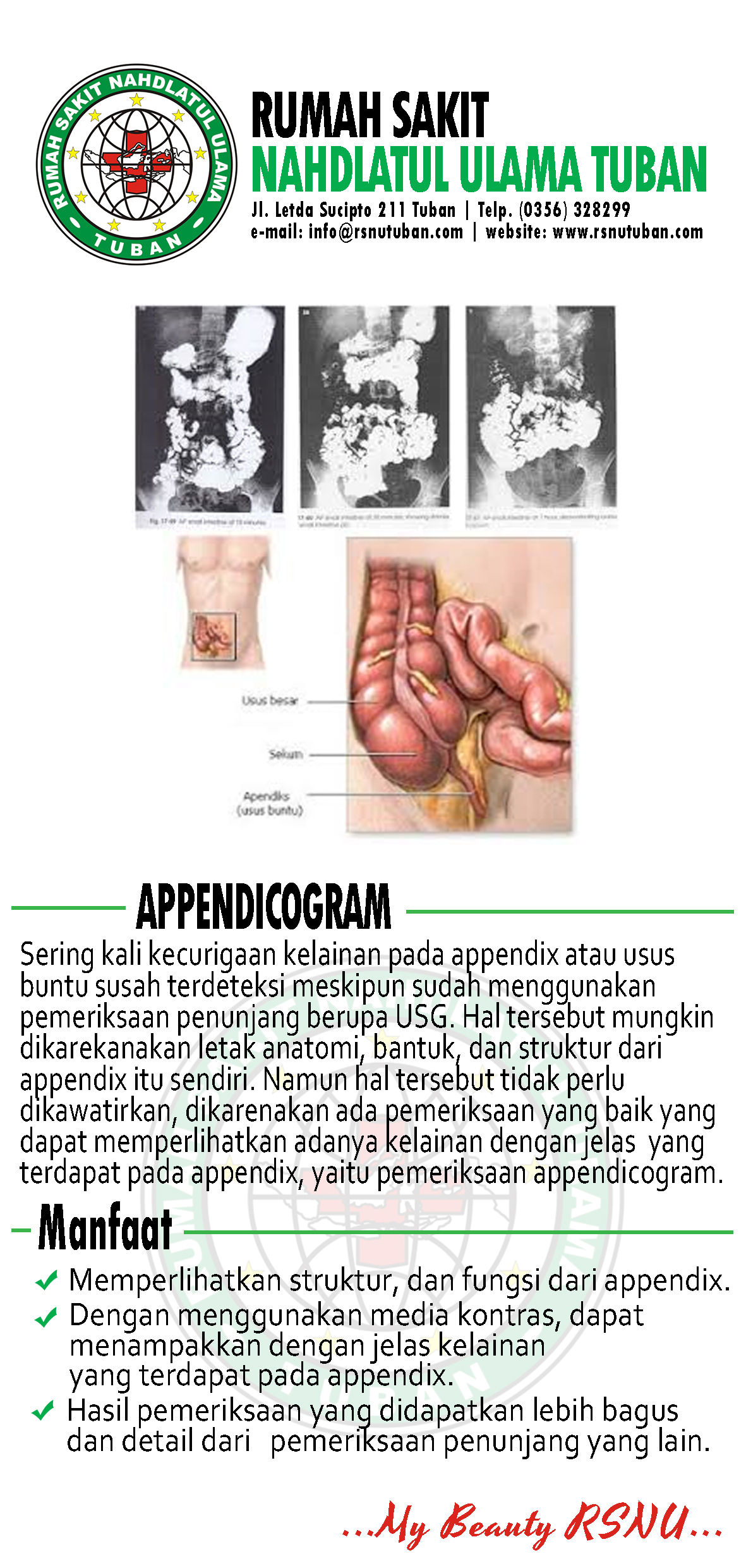 Brosur Appendicogram - RSNU Tuban