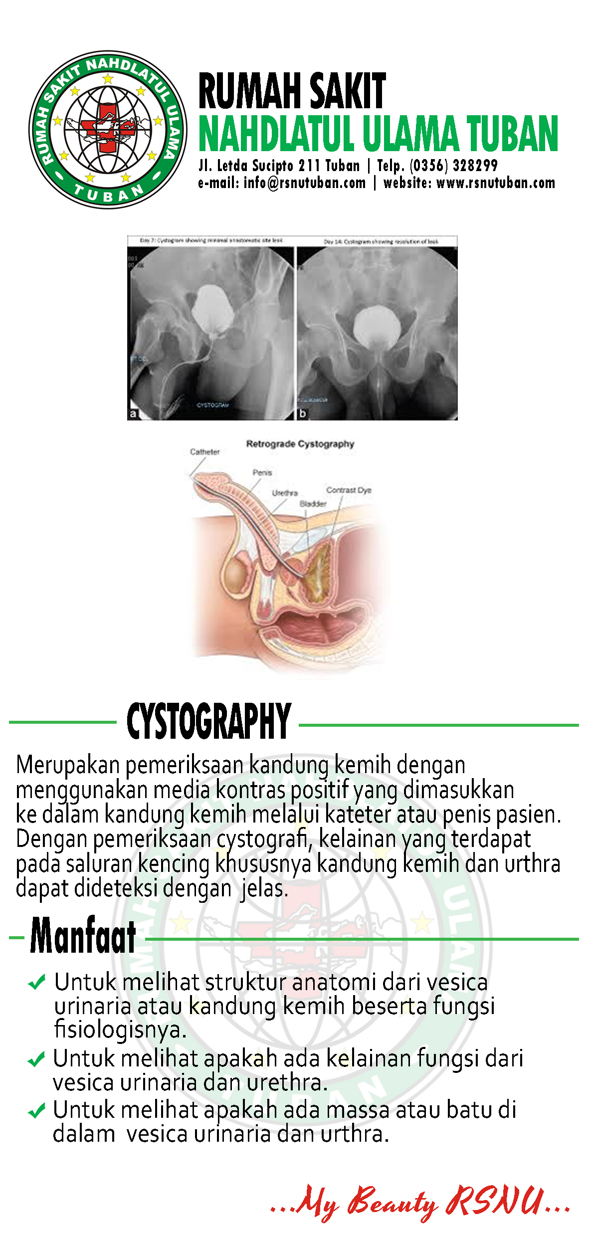 Brosur Cystography - RSNU Tuban