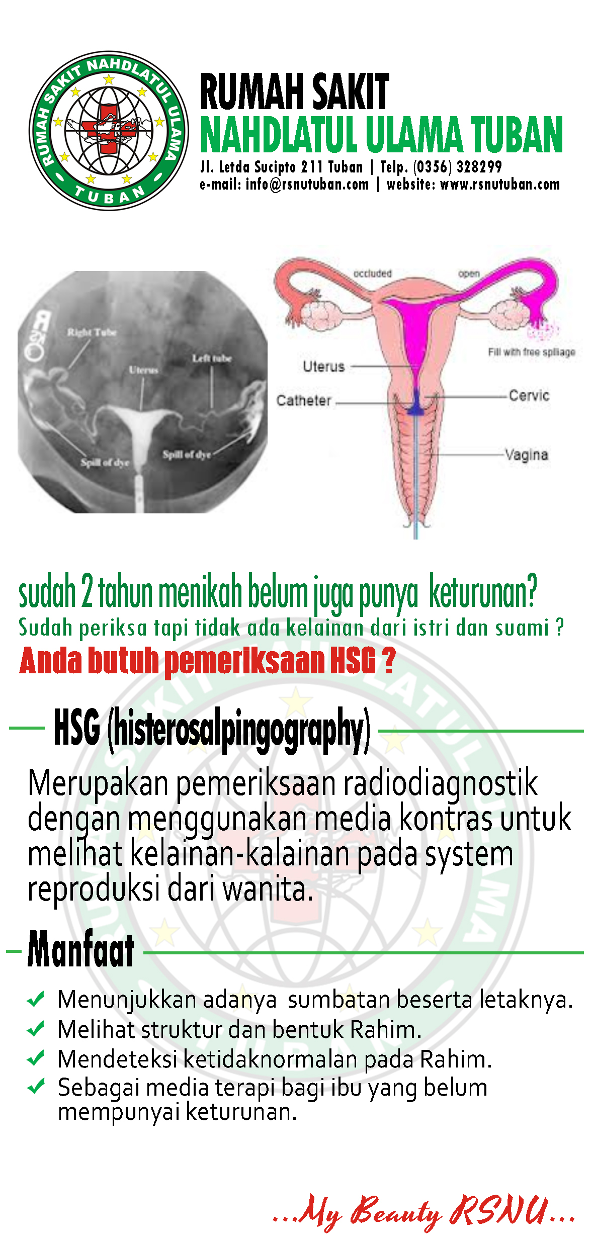 Brosur Histerosalpingography - RSNU Tuban