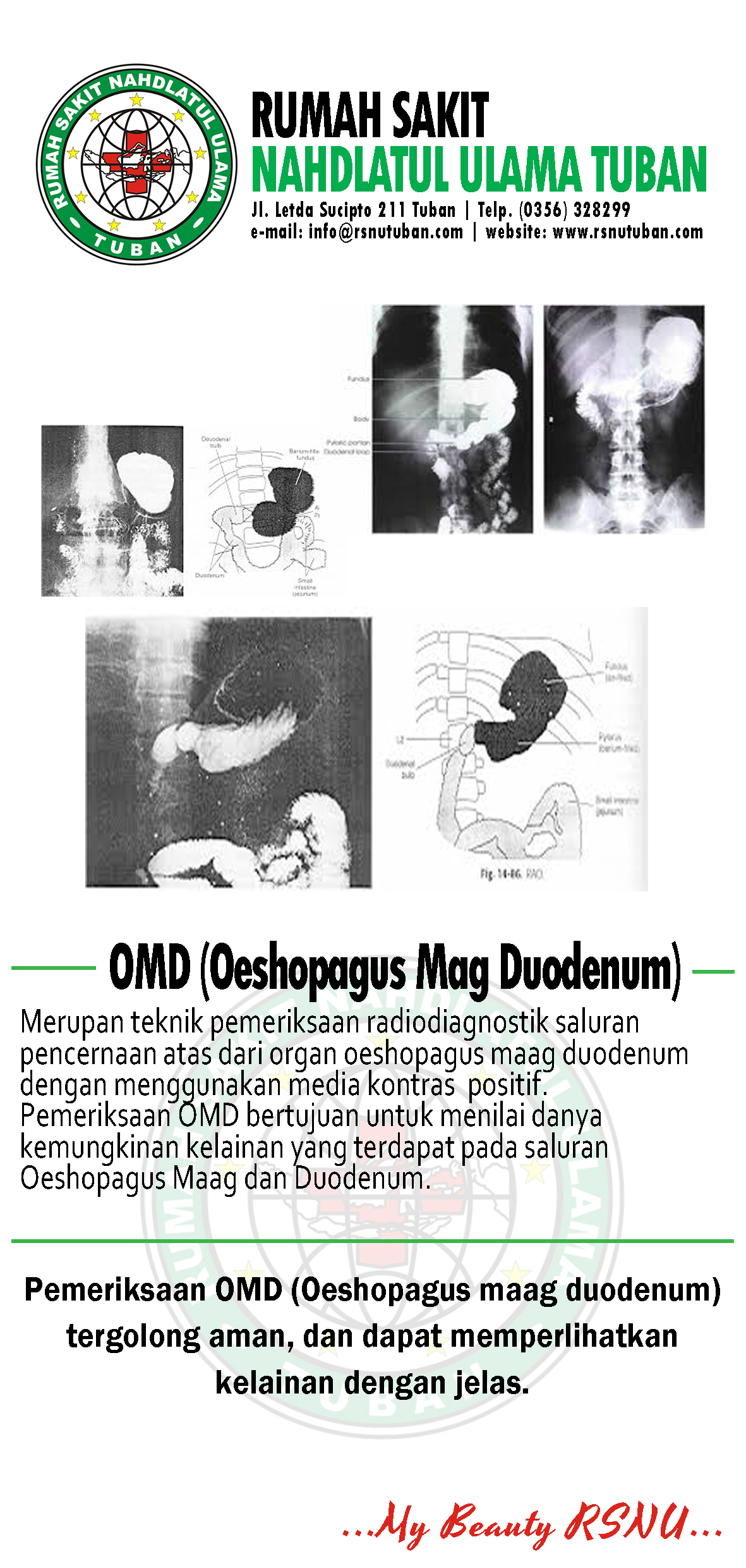 Brosur Oeshopagus Mag Duodenum - RSNU Tuban